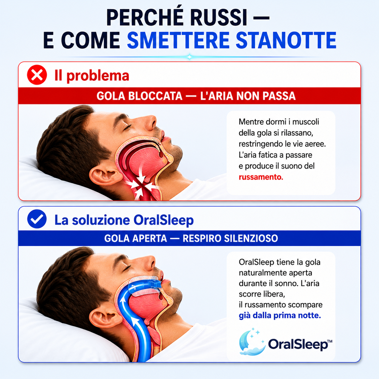 OralSleep™ – Smetti di Russare dalla Prima Notte