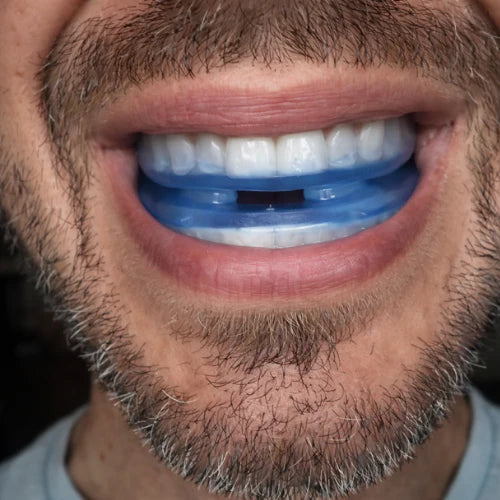 OralSleep™ – Smetti di Russare dalla Prima Notte